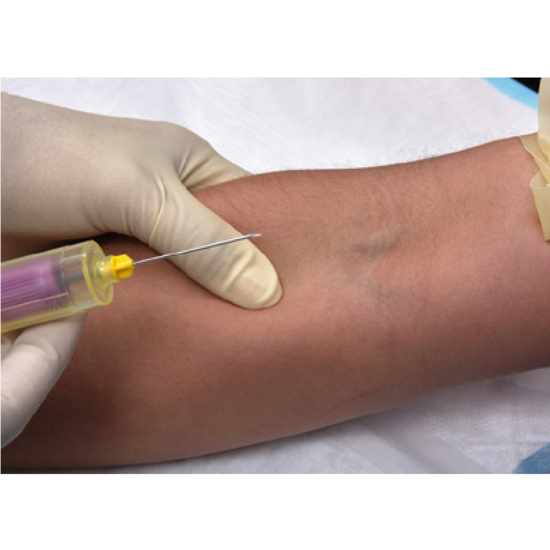 Venipuncture